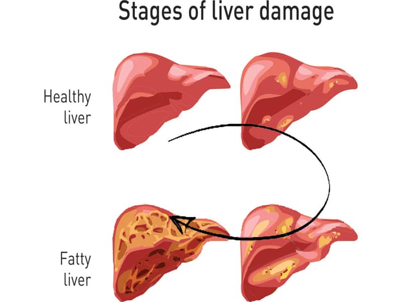 What are 4 Warning Signs of a Damaged Liver?